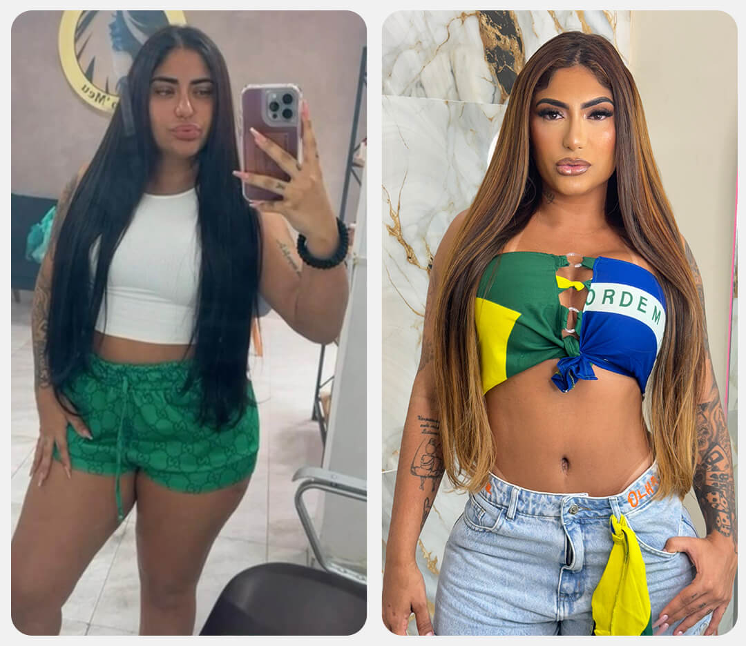 antes_depois_tirze_001