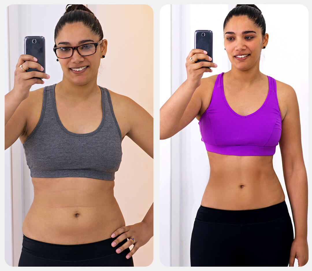 antes_depois_tirze_002