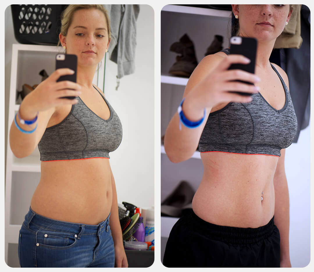 antes_depois_tirze_003